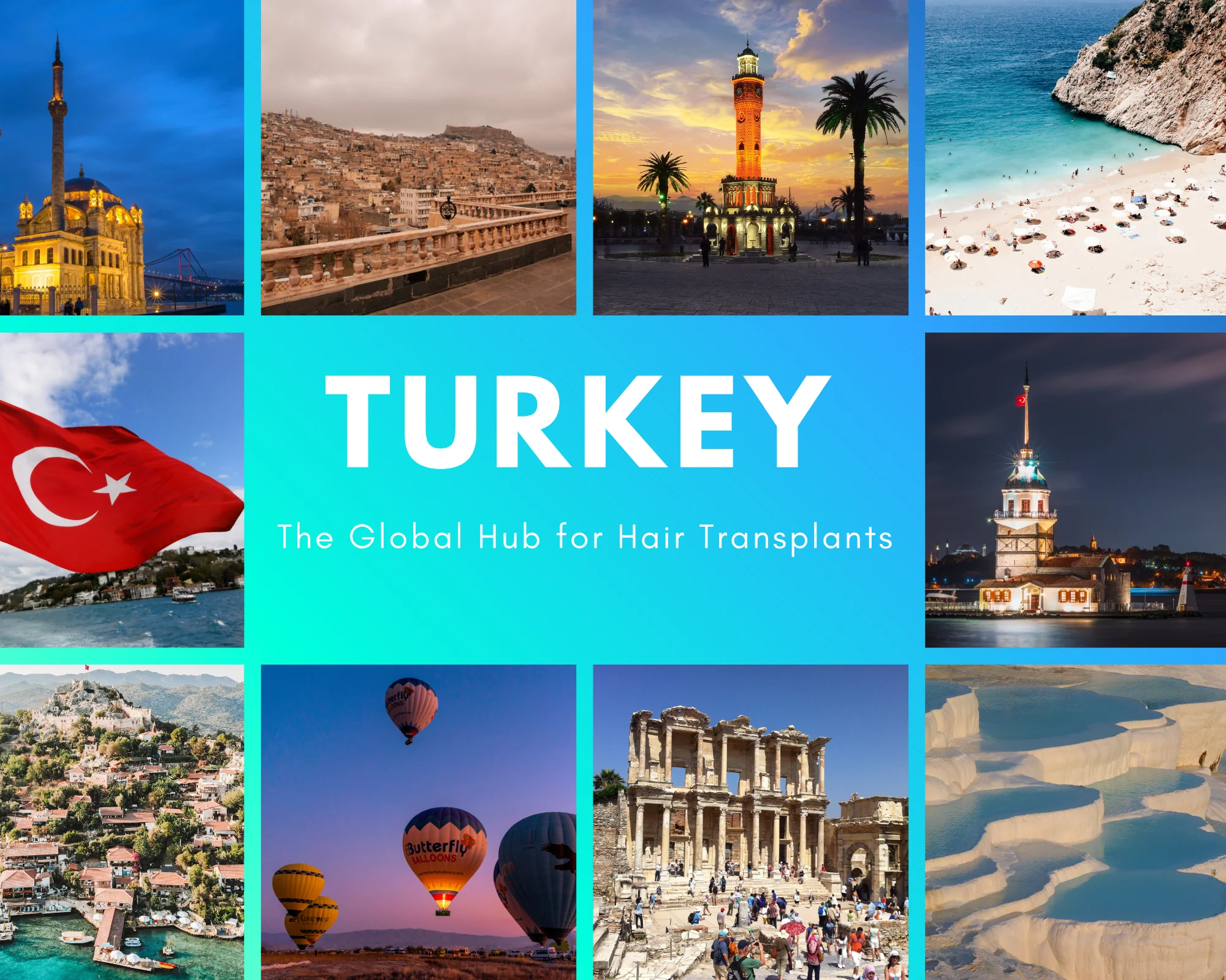 Türkei – Das globale Zentrum für Haartransplantationen